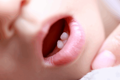 歯のメインテナンスは何歳からいくべき？